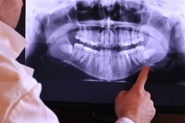 Best Cracked Tooth Emergency Dentist  in Abilene, KS